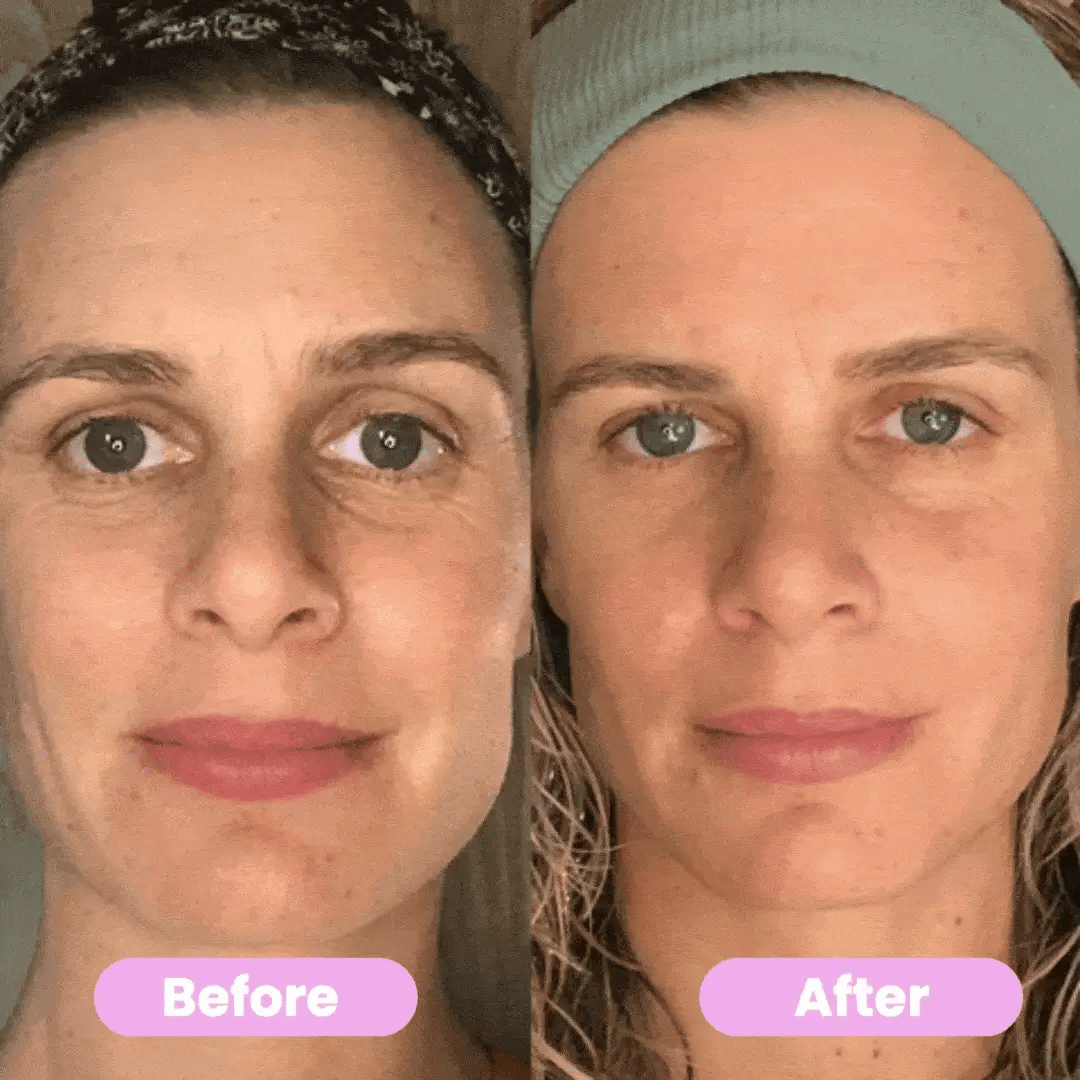 7-in-1 Anti-Aging Skin-Tightening Massager